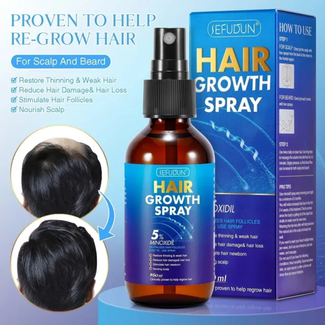 Hair growth serum anti hair loss treatment spray - regrow new hair minoxidil 5%