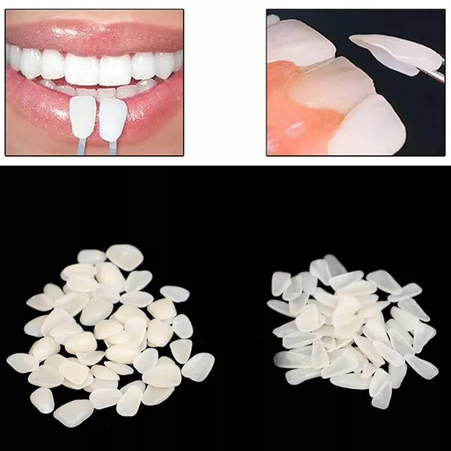 60Pcs Dental Ultra-Thin Whitening Veneers Resin Temporary Teeth Whitening'm'