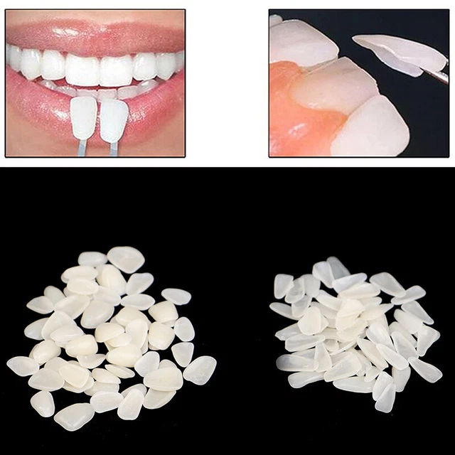 60PCS DENTAL ULTRATHIN Whitening Veneers Resin Temporary Teeth Whiten