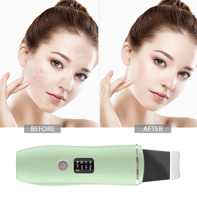 Ultrasonic on sale face cleanser