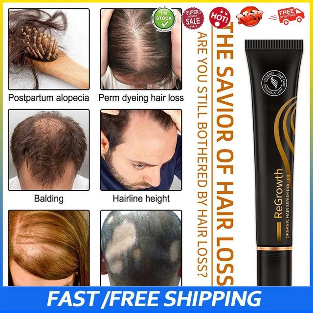 #b Rodillo de masaje nutritivo para el crecimiento del cabello esencia anti pérdida de cabello en el cuero cabelludo (con caja)