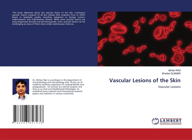 VASCULAR LESIONS OF the Skin Akhtar Riaz EUR 39,90 - PicClick DE