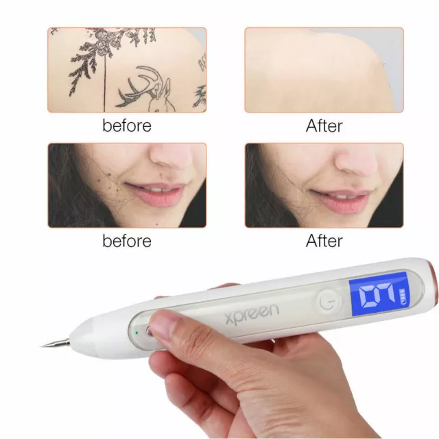 Tattoo Mole Removal Plasma Pen Laser Facial Freckle Dark Spot Remover LCD Tool