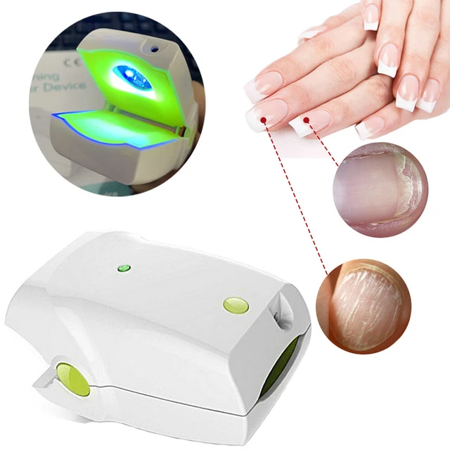NAIL FUNGUS LASER Treatment Cold Lazer Therapy Onychomycosis 905nm ...