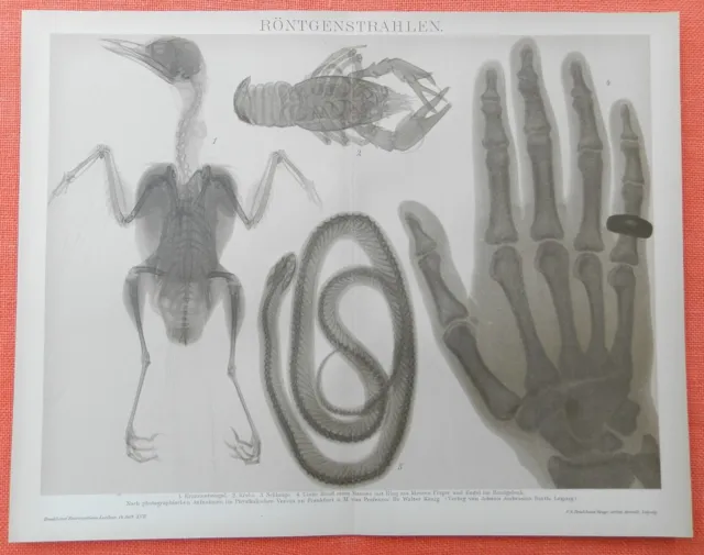 Röntgenstrahlen Röntgenbilder Schlange Hand Radiologie Lithographie 1895