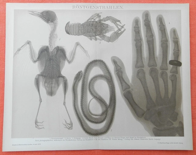 Röntgenstrahlen Röntgenbilder Schlange Hand Radiologie Lithographie 1895