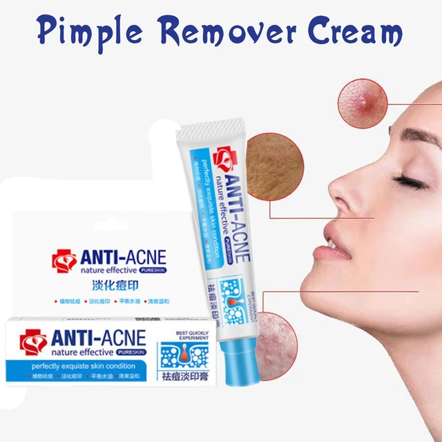 Acne removal on sale cream