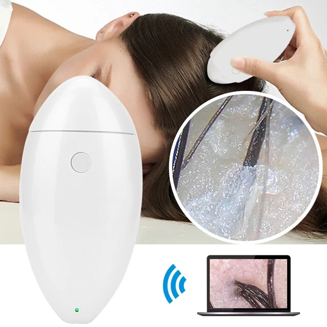 Wireless HD WIFI Hair Follicles Scalp Detector Digital Skin Analyzer Microscope
