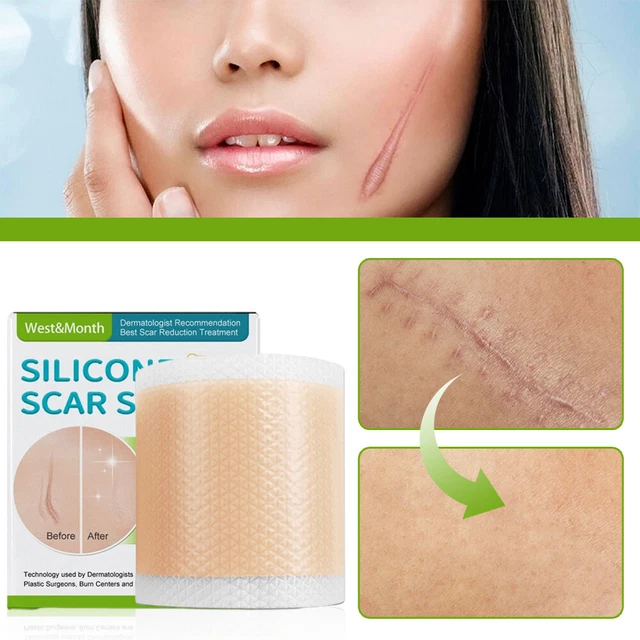 SILICONE TAPE SCAR Hyperpigmentation Reducer Medical Grade Adhesive