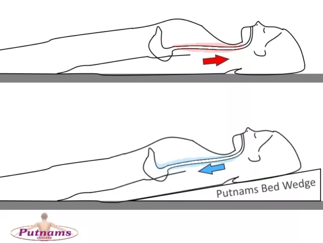 Putnams Acid Reflux Bett Keilabsatz - HERGESTELLT IN UK ✔ Abdeckung enthalten ✔ 2 JAHR GARANTIE ✔ 2