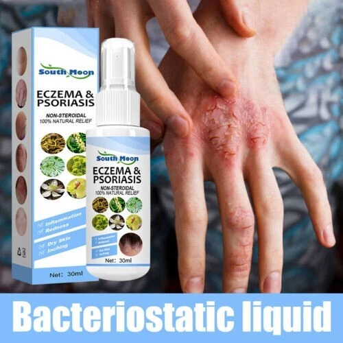 SKIN PSORIASIS SPRAY Herb Essence Dermatitis Eczematoid Eczema 16.00