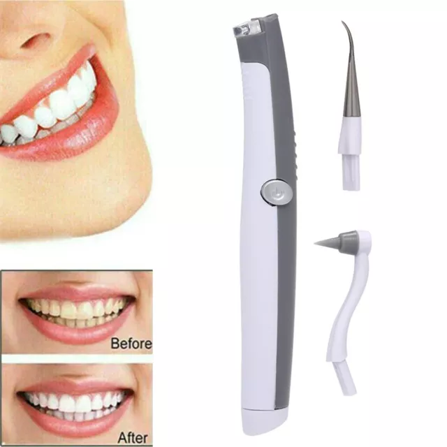 Electric ultrasonic Dental Scaler Teeth Cleaner Calculus Plaque Stains Remover