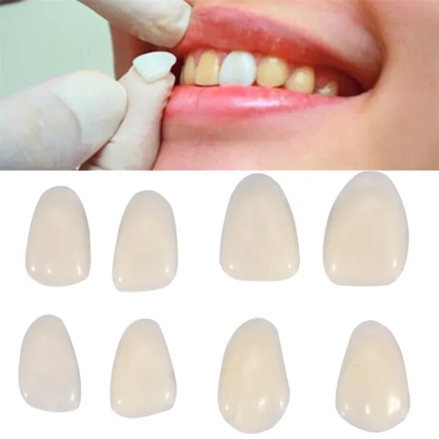 70Pcs Dental Temporary Crown Veneers for Anterior Front Teeth Whitening US Stock