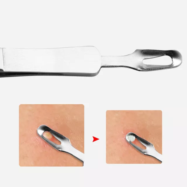 Facial extractor blackhead acne blemish remover tweezers bend curved needle‘3CFZ