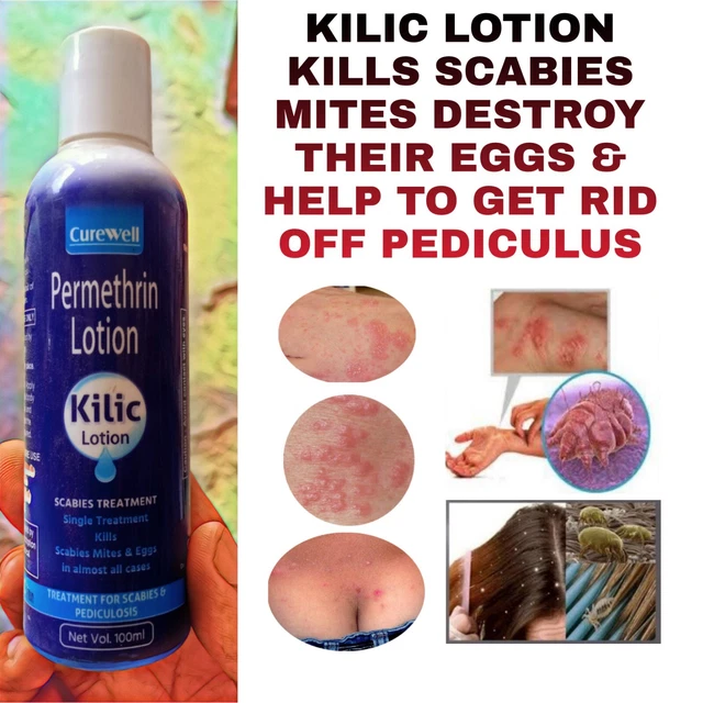 KILIC ANTI SCABIES Kills Scabies Mites And Eggs Complete Eradication