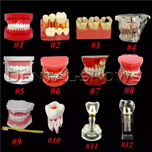 Dental Implant Teeth Model Teach Study Teaching Adult Analysis Demonstration