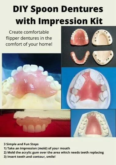 DIY Denture Basic Kit WITH Impression Kit Model Cast, Fun and Simple, Affordable