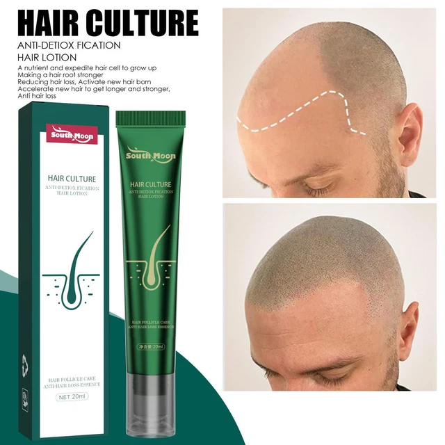 Suero de jengibre esencia para el crecimiento del cabello antipérdida de cabello cuidado de reparación de crecimiento rápido] cabello Z9I2