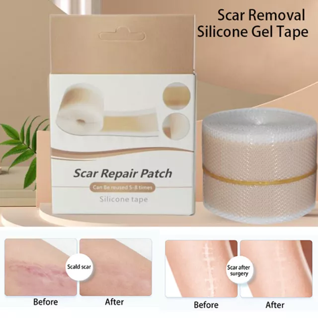 Cinta de gel de silicona autoadhesiva para eliminar cicatrices de belleza eficiente PNHUK