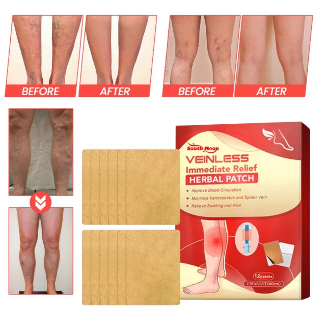 Veinless Relief Herbal Patch Varicose Veins Patches Vasculitis Support Leg Care