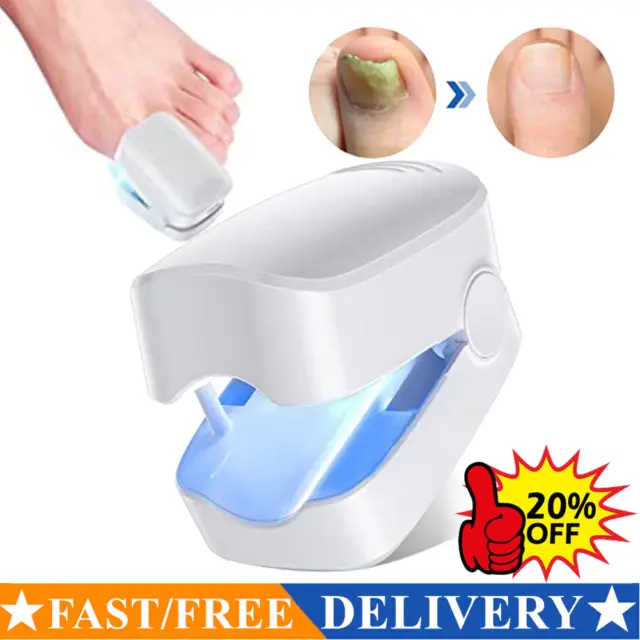 Anti Fungal Laser Device Finger Toe Nail Fungus Remover Onychomycosis Home—Treat