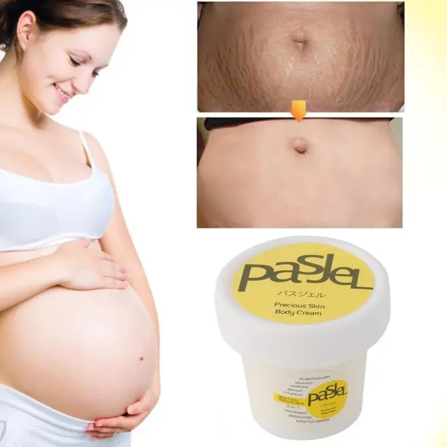 Pasjel Afy Schwangerschaftsmarken Dehnungsmarken Narbenentferner G4D5 Cream A7S4