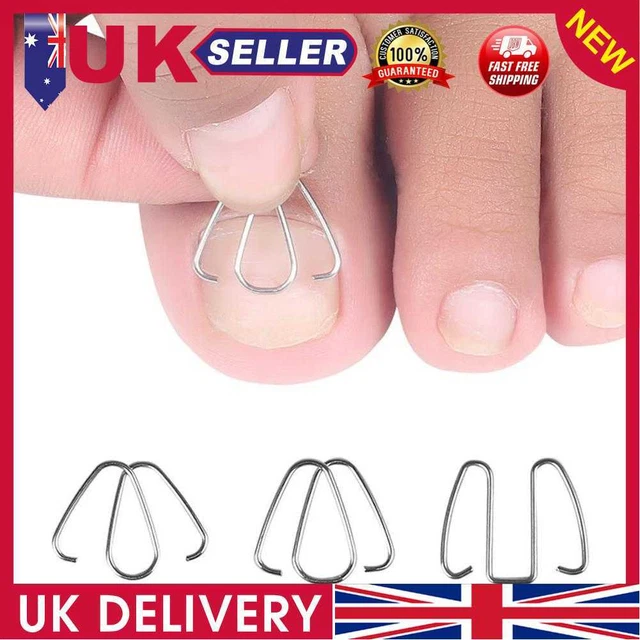 INGROWN NAIL GROOVE Correct Hook Orthosis Paronychia Treatment Clip