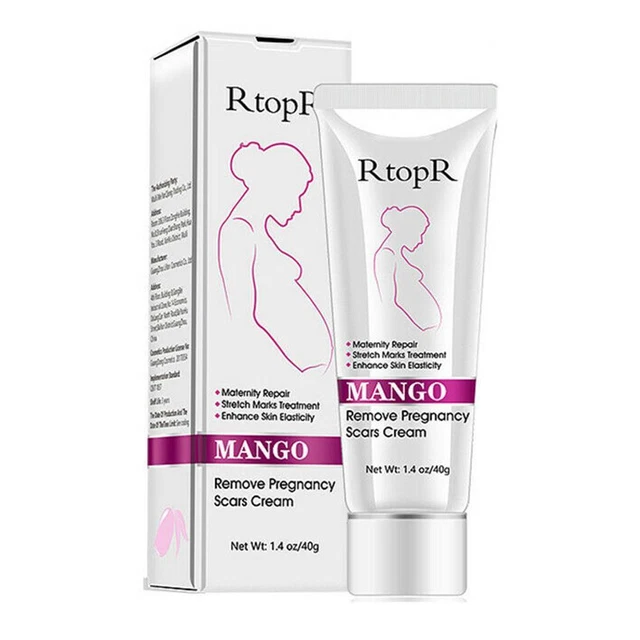 40 ml RtopR Mango Eliminar Cicatrices Embarazo Acné Crema Caliente Stretch I8Q9 B9S7 M8I7