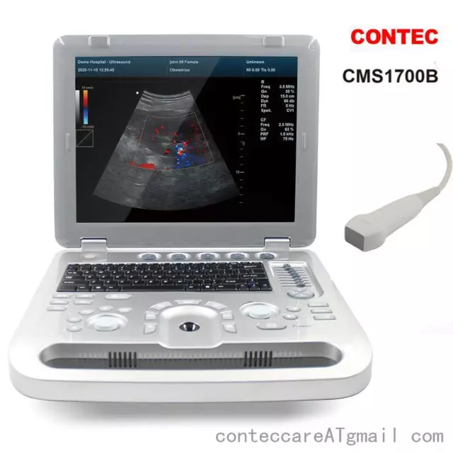 CONTEC Digita Color Portable Ultrasound Scanner CMS1700B with Phased array Probe