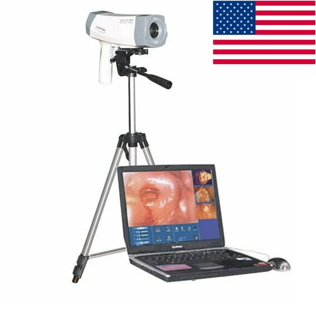 Digital Video Electronic Colposcope 480,000 Pix Camera Software & 1 Tripod FDA