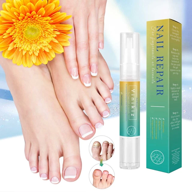 Nail Repair Pen Toenail Pen Toenail And Nail Care Nail Repair Pens Nail Support