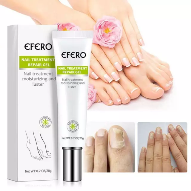 Nail Repair Essence Remove Onychomycosis Serum Fungal Nail Treatment O1E2