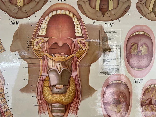 ANTIQUE VINTAGE ADAM Rouilly Wall Chart Poster Medical Throat £94.95 ...