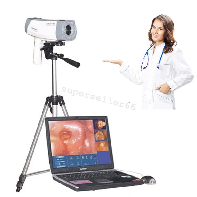 Carejoy new 480,000 pixels Digital Video Electronic Colposcope Gynecology FDA