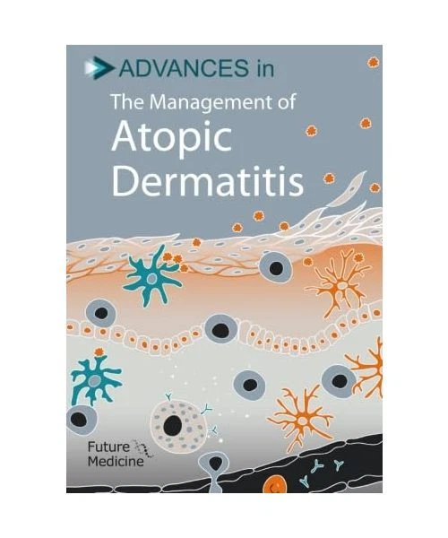 ADVANCES IN THE Management of Atopic Dermatitis, Thomas Bieber EUR 53 ...