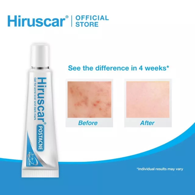 Hiruscar Postacne Gel zur Reduzierung von Narben & dunklen Flecken durch Akne 10g 3