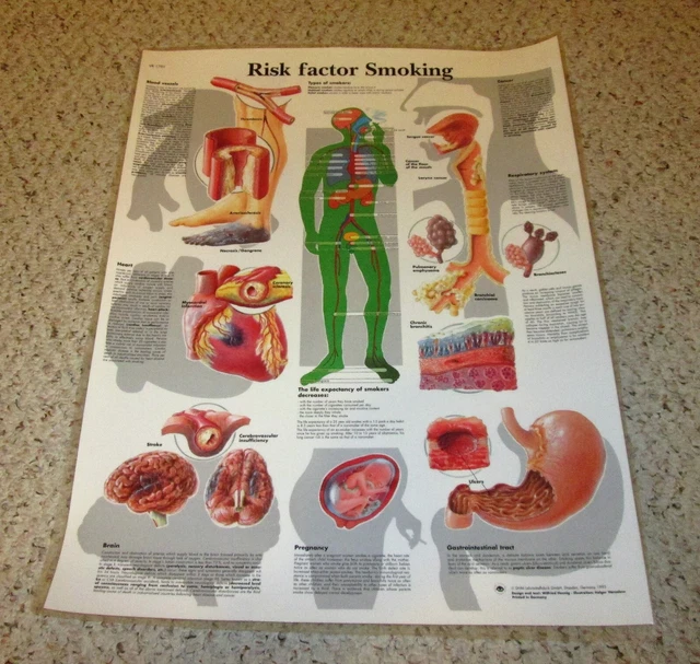 SMOKING RISK FACTORS Laminated Wall Chart Poster 20” x 26” Color