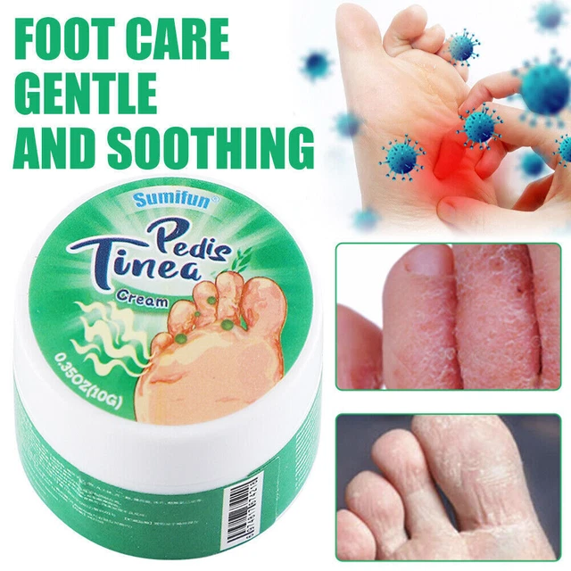 PEDIS TINEA CREAM Antibacterial Ointment Beriberi Treat Tinea Odor Foot