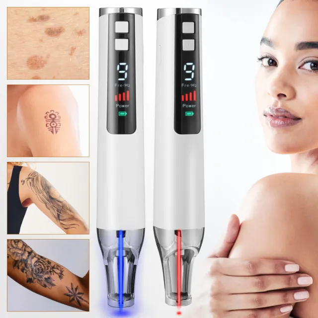 Picosecond Laser Stift Mole Warze Narbe Akne Tattoo Entfernung Stift Plasma Pen