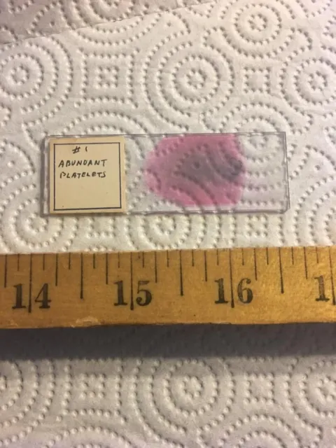 Antique Vintage Microscope Slide  "Abundant Platelets"