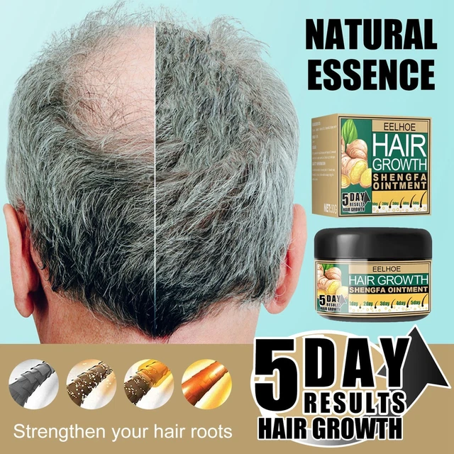 Tratamientos densos de pérdida de cabello reparación pomada crema para el crecimiento del cabello aceite de jengibre