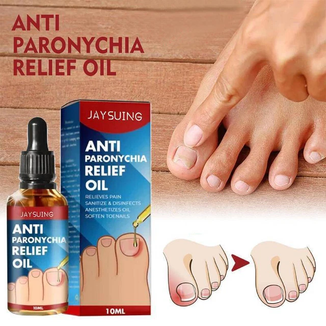 Nutrición para uñas alivio dolor uñas de los pies aceite reparación anti paroniquia curación ◑