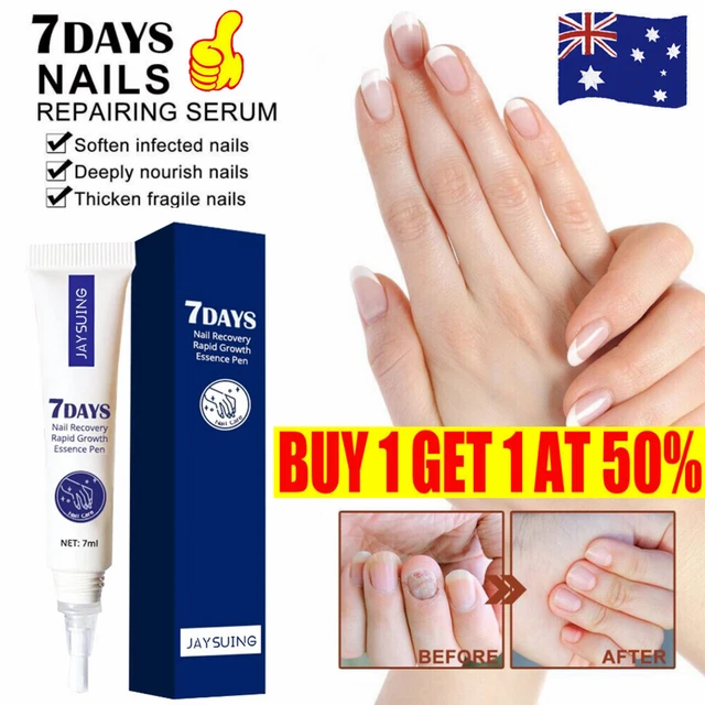 ANTI FUNGAL NAIL Treatment Finger Toenail Care Nail Fungus Treatment