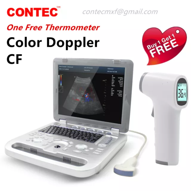 New Color Doppler Ultrasound Scanner Portable Laptop Machine 3.5Mhz Convex Probe
