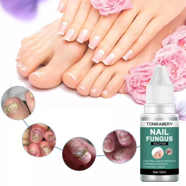 Fungal Nail Repair Essence Serum Care Treatment Foot Fungus Nail Removal Z9B4