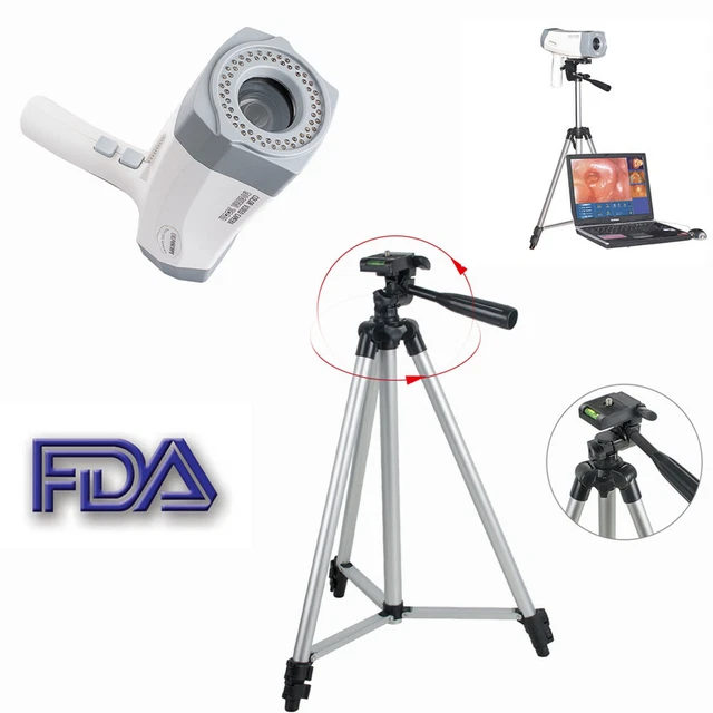 Portable Video Electronic Colposcopy 800,000pixels Image Vaginal +Tripod CE