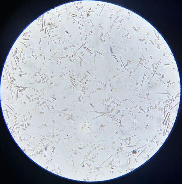 J.D. Moller Microscope Slide Diatom Aqua Dulcis Mahe Seychelles Islands 1869