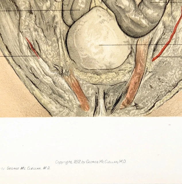 1892 Abdominal Region Stomach Artery Anatomical Lithograph Dr. George McClellan