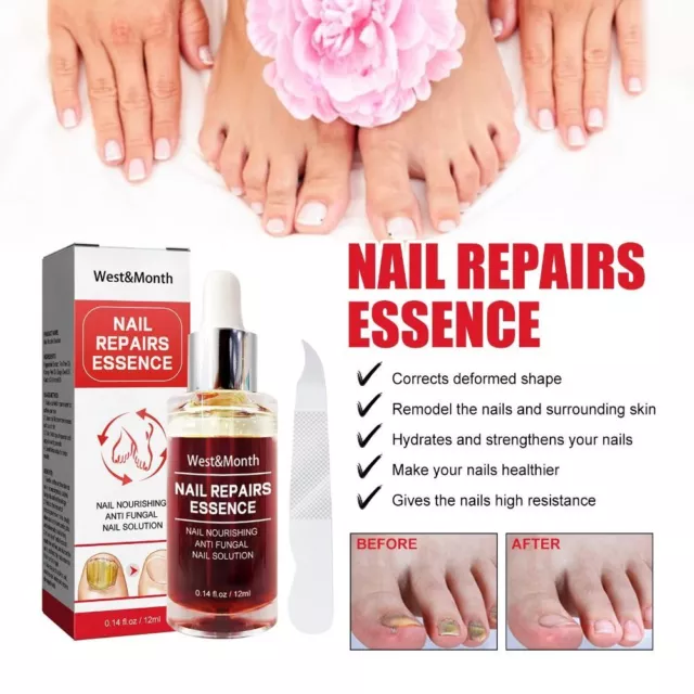 Soins des pieds Essence de réparation des ongles  Main et pied