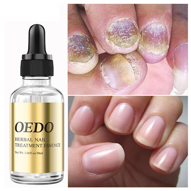 Esmalte de Uñas Cuidado Salud Tratamiento Reparador Esencial Solution 30ml <